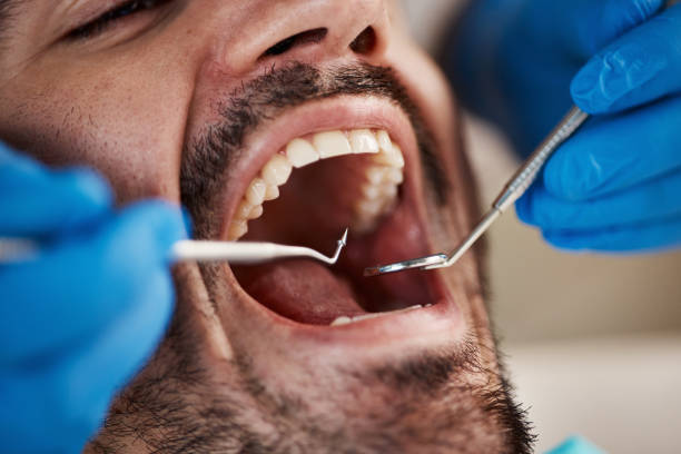 Best Dentures (Full and Partial)  in Chouteau, OK